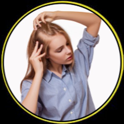 Beyond Smile Hair Transplant